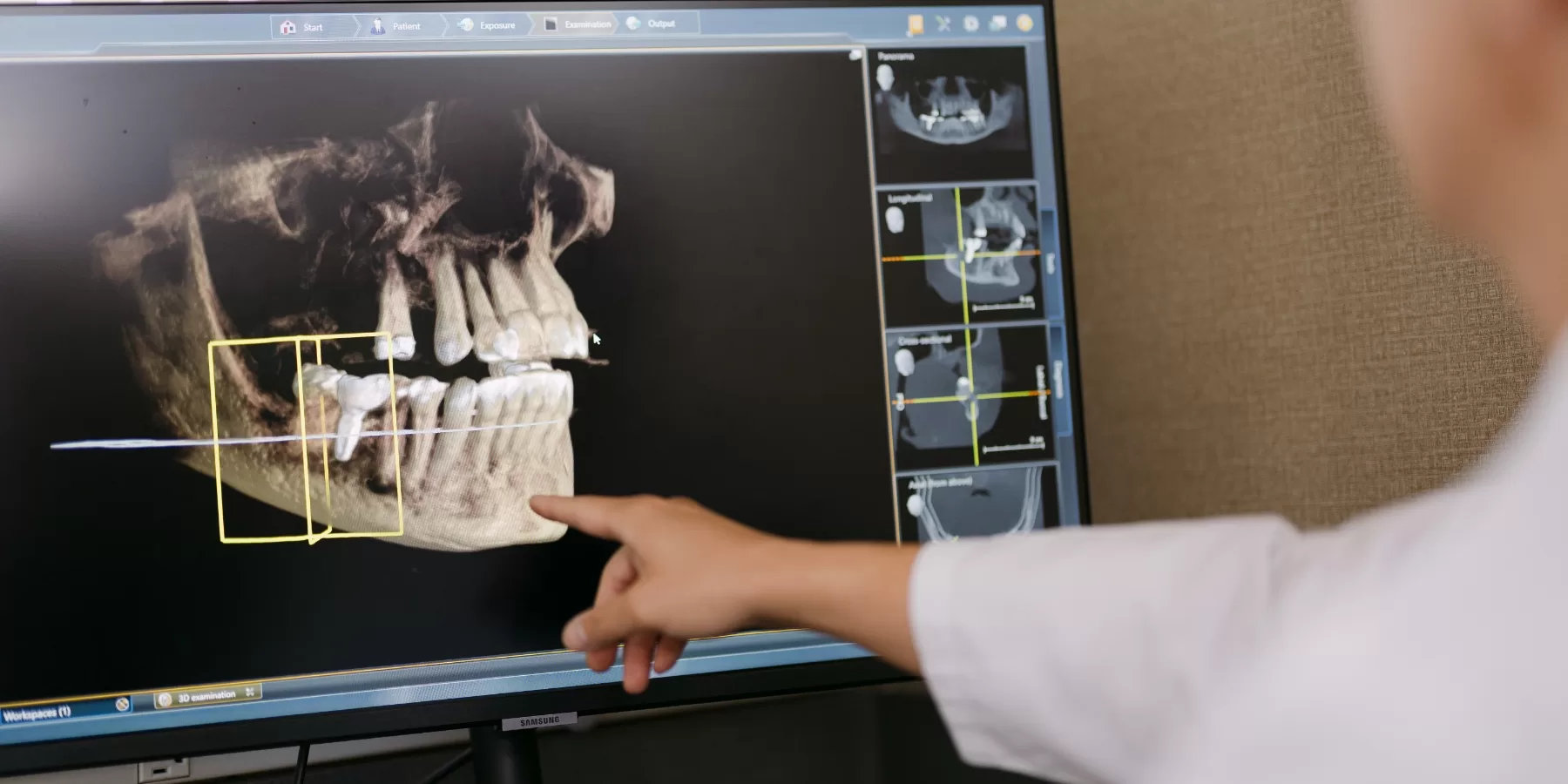 Foothillour technologypic | foothill center for dental implants and oral surgery Foothillour technologypic